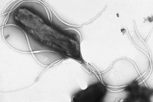 Mynd af <em>Helicobacter pylori</em>, tekin í rafeindasmásjá. Á myndinni má jafnframt sjá svipur bakteríunnar sem gerir henni kleift að hreyfa sig. Mynd af <em>Helicobacter pylori</em>, tekin í rafeindasmásjá. Á myndinni má jafnframt sjá svipur bakteríunnar sem gerir henni kleift að hreyfa sig.