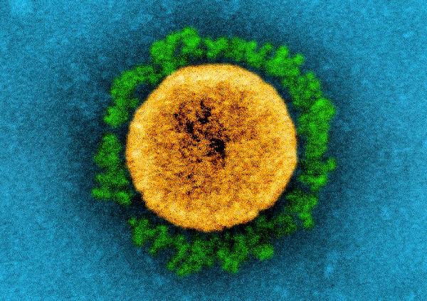 Hvað varð um COVID, er það bara kvef núna?