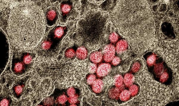 Hvað er vitað um dreifingu COVID-19, alvarleika og áhrif á samfélagið fimm árum eftir heimsfaraldur?